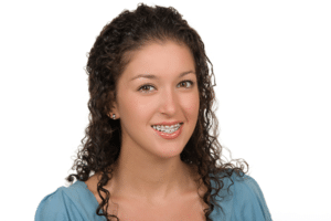 Affordable Braces in Bronx NY