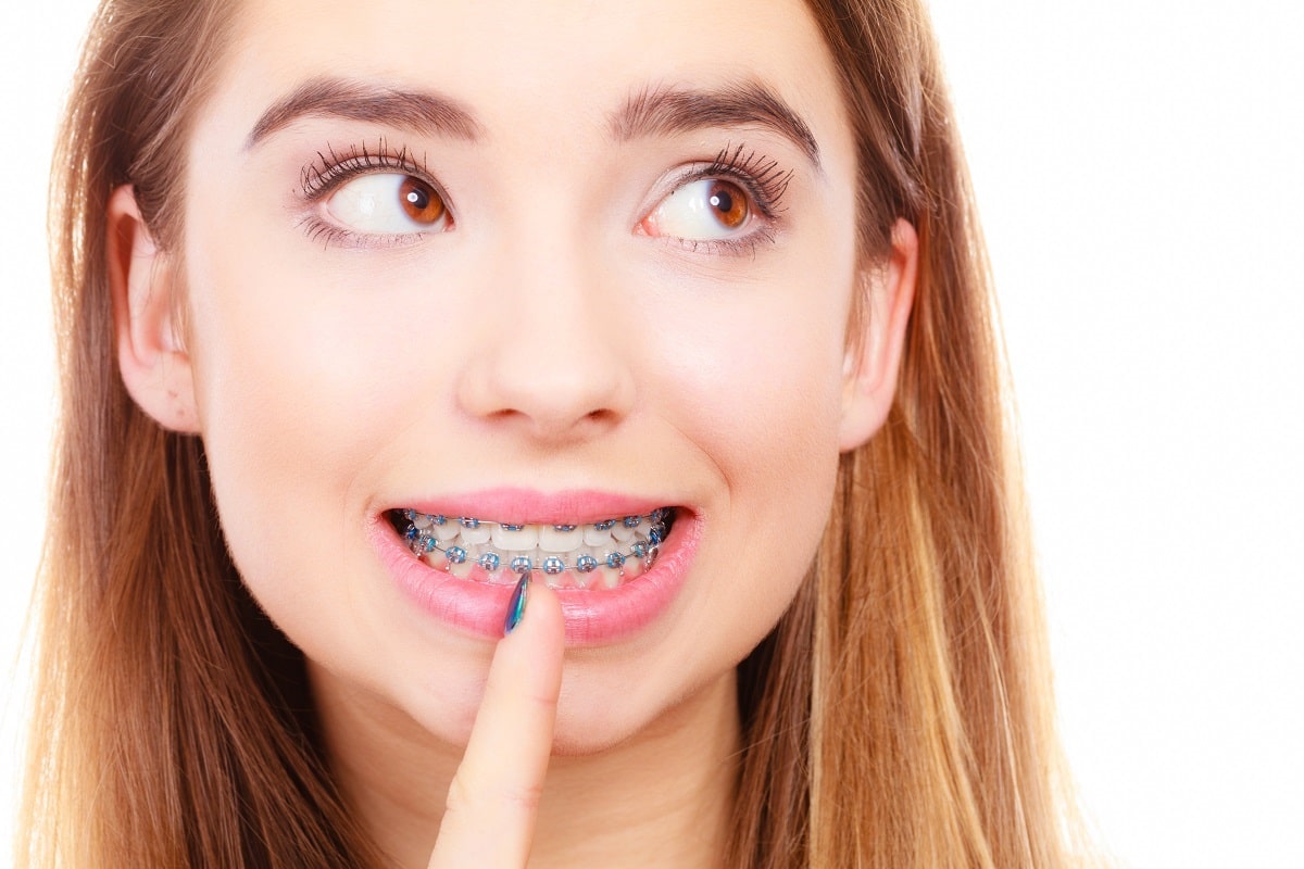 Braces & Invisalign In The Bronx, NY Northeastern Braces