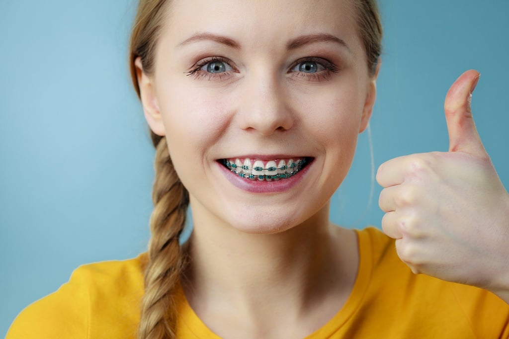 Affordable Braces In The Bronx Northeastern Braces