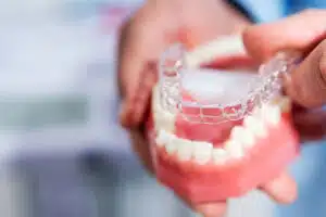 invisible braces