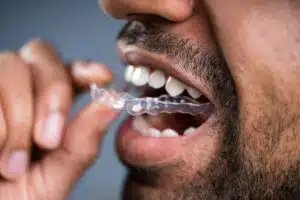 Eating with Invisalign: Expert Advice to Avoid Common Mistakes