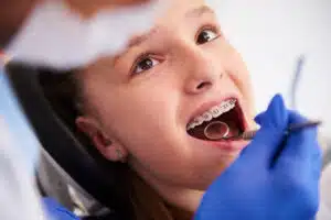 How Dental Braces Correct Common Orthodontic Issues