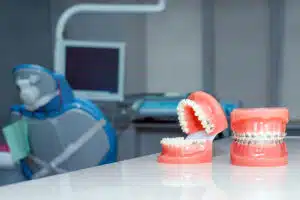 How Dental Braces Correct Common Orthodontic Issues