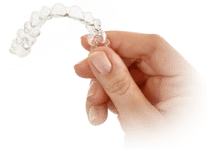 Invisalign Journey: Key Milestones & Stages Explained