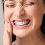 How to Manage Braces Discomfort