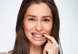 How to Manage Braces Discomfort