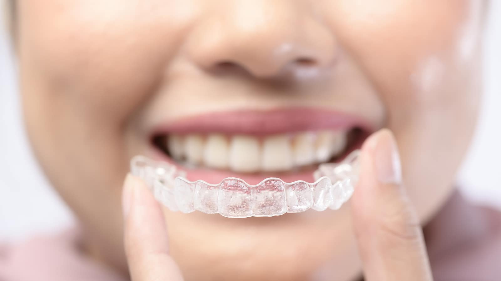 Young woman holding a clear aligner tray showing invisalign attachment benefits for guided tooth movement