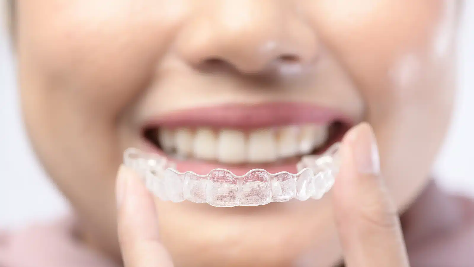 Young woman holding a clear aligner tray showing invisalign attachment benefits for guided tooth movement