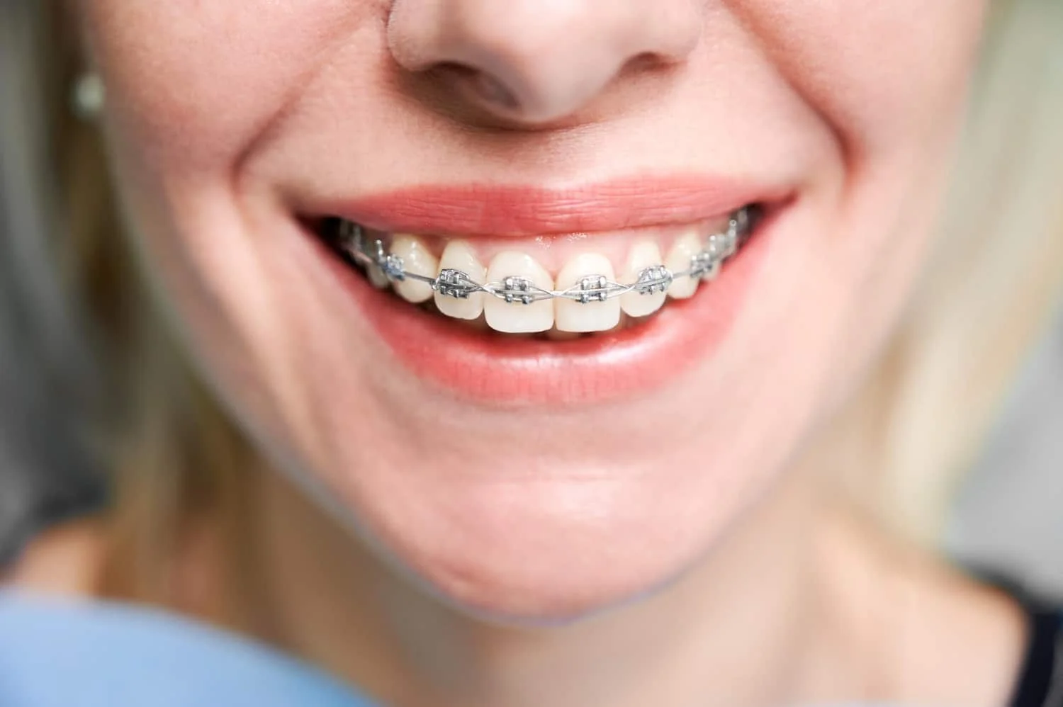 braces Newburgh NY