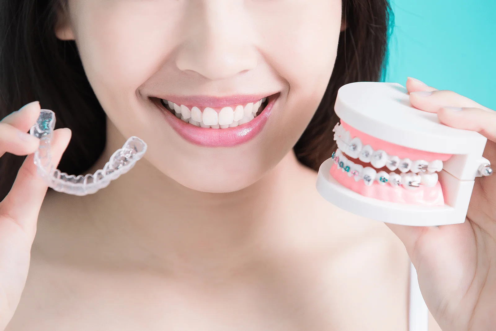 Patient holding a clear aligner and dental model demonstrating what are invisalign attachments in orthodontic treatment 